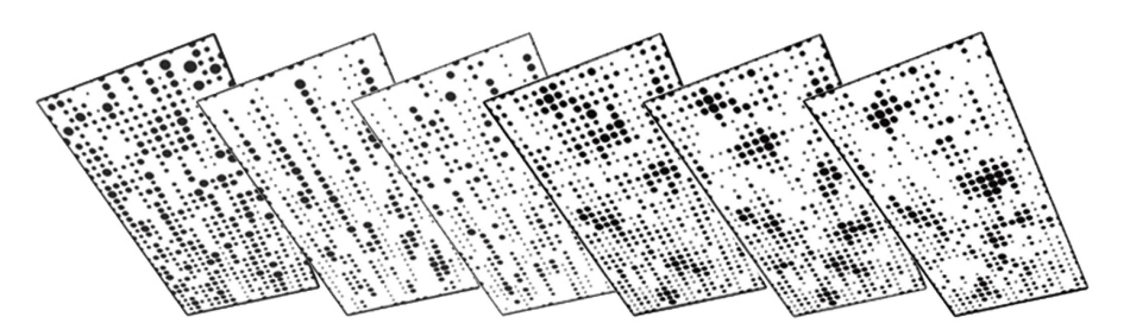NUVO X-Presiv Series Example